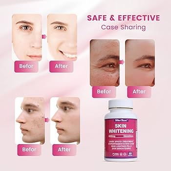 Wins Town Skin Whitening Collagen - Image 3