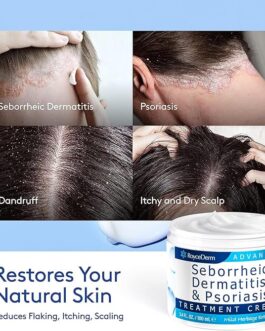 Roycederm Seborrheic Dermatitis Cream