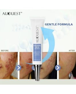Acne Remoyal Gure Gel -Herbal Acne Treatment Cream Pimple Spot Removal for Teens Oil Control Acne Scar Gel Shrink Pores Skin Care Beauty Health 20g