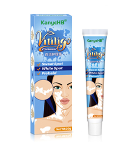 Kanyehb Vitiligo Ointment Care Cream -20g